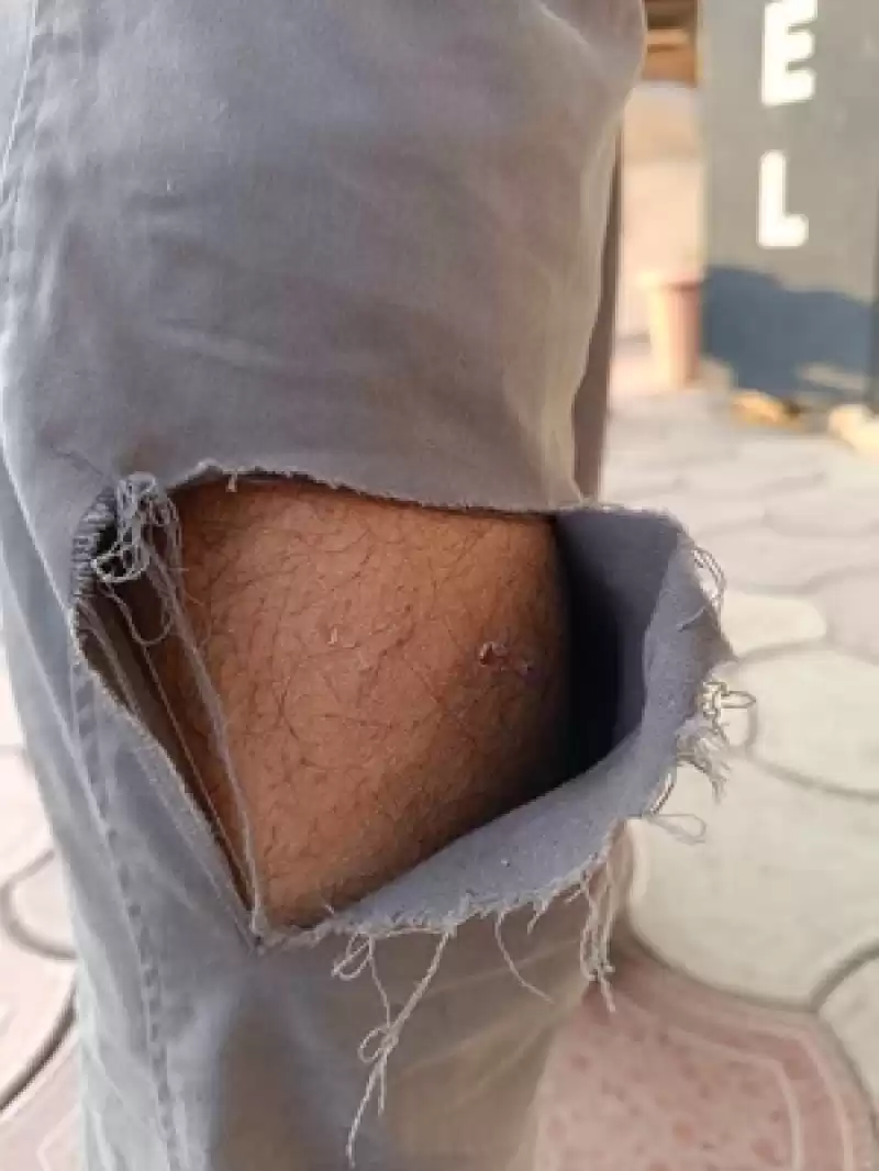 Hatay'da Sahipsiz Köpeklerin Saldırısına Uğrayan Motosikletli Yaralandı