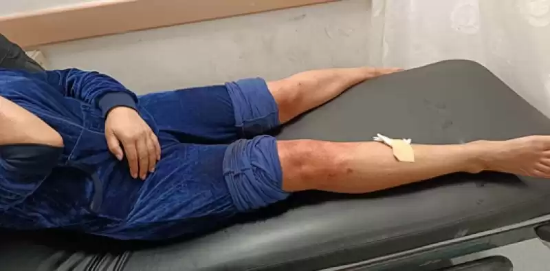 Hatay'da Sahipsiz Köpeklerin Saldırısına Uğrayan Kadın Yaralandı
