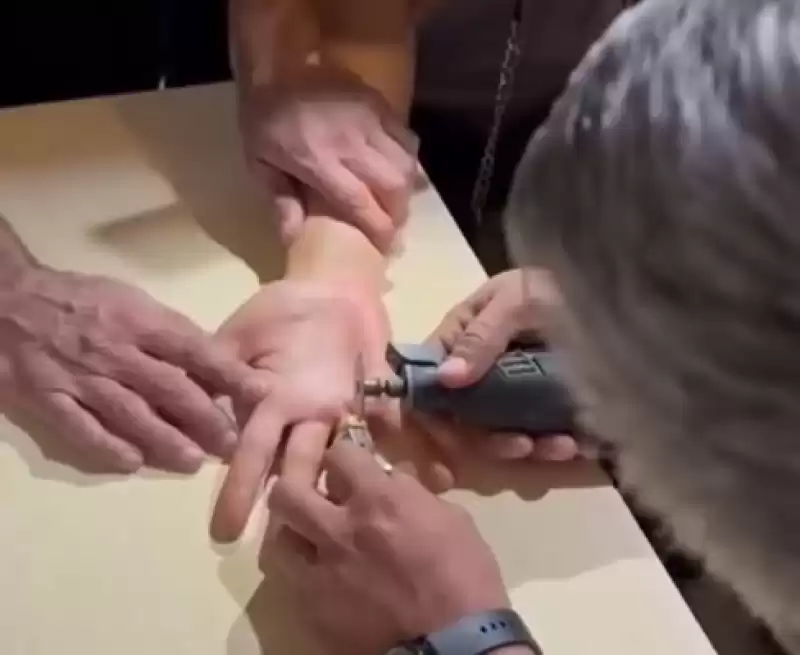 Parmağına Sıkışan Yüzüğü Itfaiye Ekipleri çıkardı