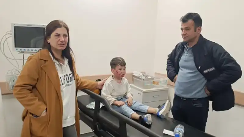 Hatay'da Sahipsiz Köpeğin Saldırısına Uğrayan çocuk Yaralandı