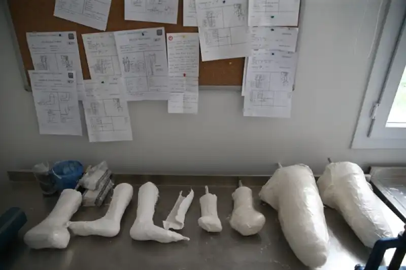 Hatay'da Ampute Depremzedeler, Kurulan Merkez Sayesinde Tedavi Için Il Dışına Gitmiyor