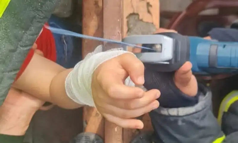 Dikkatsiz Çocuğun Kolu Demir Korkuluklara Saplandı!