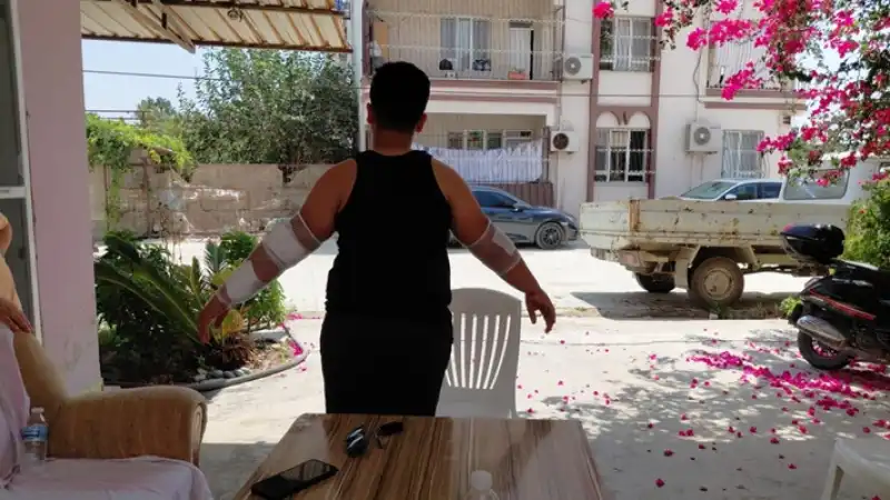 Hatay'da Sahipsiz Köpeğin Saldırdığı çocuk Yaralandı 