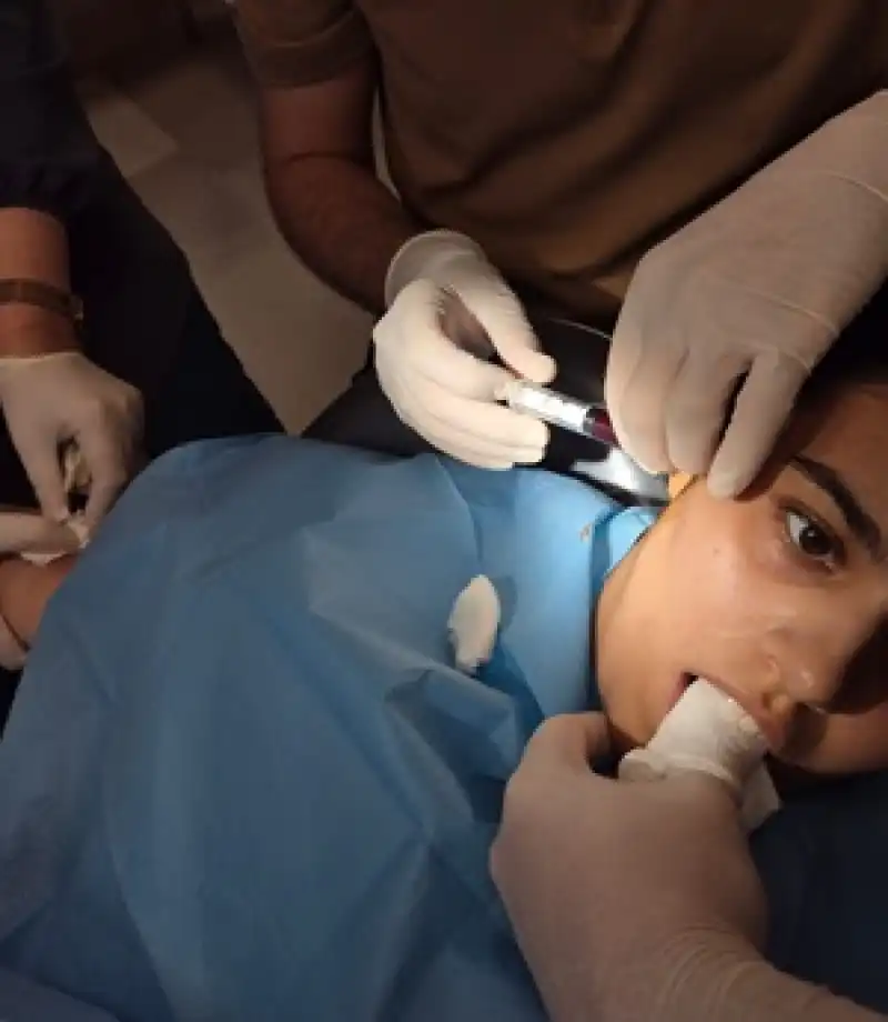 İskenderun Ağız Ve Diş Sağlığı Hastanesi’nde Çene Eklemi Çıkığına Tedavi Yöntemi 