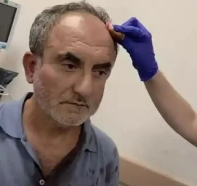 AÇKD’den Saldırıya Kınama!