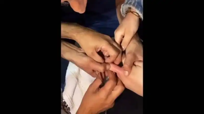 Hatay’da Parmağa Sıkışan Yüzük Çıkarıldı