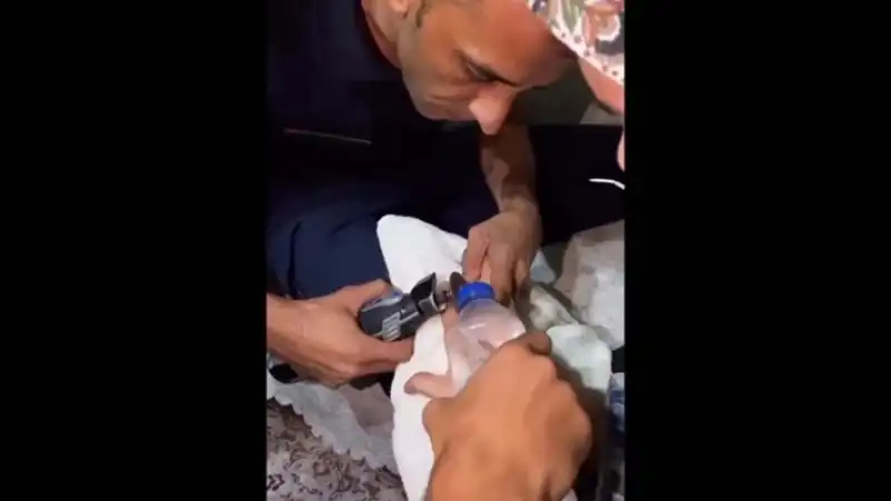 Hatay’da Parmağa Sıkışan Yüzük Çıkarıldı