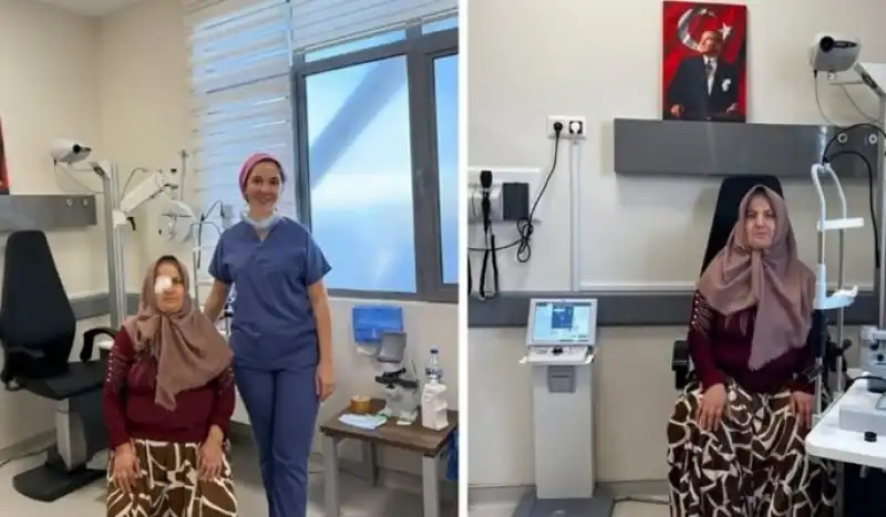 Çift Görme Şikâyeti Katarakt Ameliyatıyla Sona Erdi
